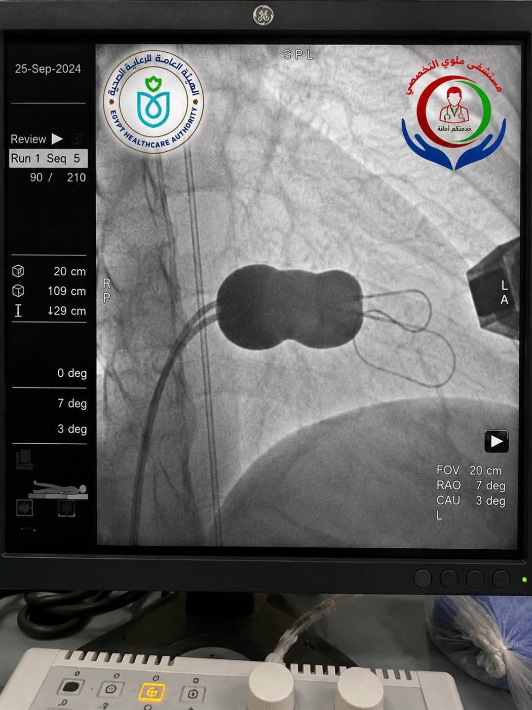 قسم القلب والقسطرة بمستشفى ملوي التخصصي، فيتو 