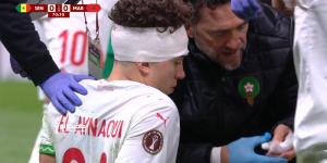 منتخب المغرب.. إصابة قوية لنائل العيناوي لاعب المغرب في رأسه أمام السنغال بنهائي كأس الأمم الإفريقية