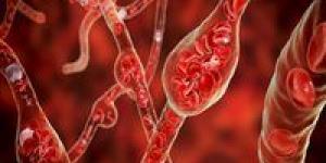 تحذيرات
      علمية
      دولية..
      عامل
      بيئي
      خفي
      وراء
      ارتفاع
      ضغط
      الدم