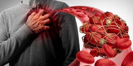 أعراض انسداد شرايين القلب وطرق التعامل معها