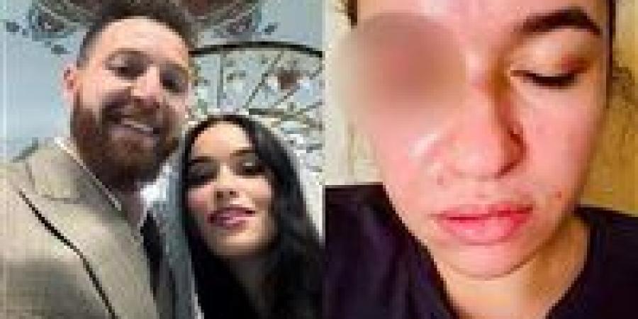 نفقة على الورق فقط.. حكم قضائي يُلزم محمود حجازي والزوجة: لم ينفذ حتى الآن