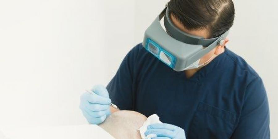 وزارة الصحة تطلق حملة رقابية على مراكز زراعة الشعر لضبط المخالفات ورفع جودة الخدمات