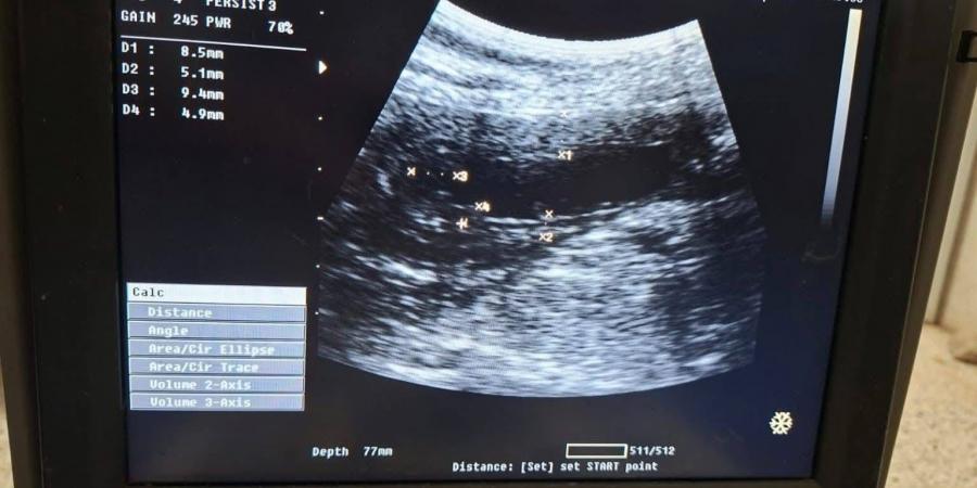 مستشفى
      الطب
      البيطري
      بجامعة
      قنا
      تستقبل
      حالة
      نادرة
      لكلبة
      جيرمان
      شيبرد
      تعاني
      من
      نزيف
      بالبول
      وخمول
      مزمن