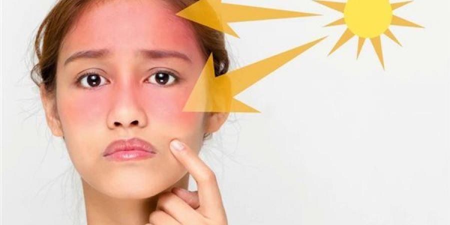 حروق
      واحمرار
      وطفح
      جلدي،
      هيئة
      الدواء
      تحذر
      من
      تفاعل
      هذه
      الأدوية
      مع
      أشعة
      الشمس