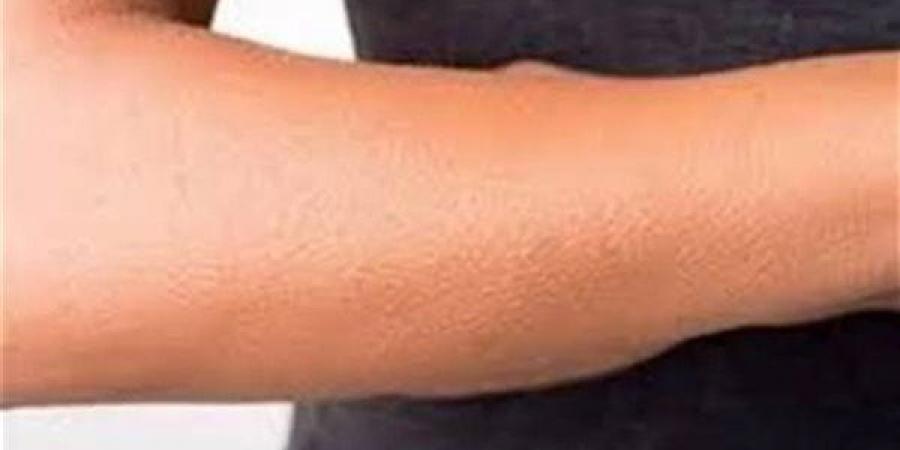 تفسير رؤية الجلد في المنام وعلاقتها بوجود بعض الأصدقاء المنافقين