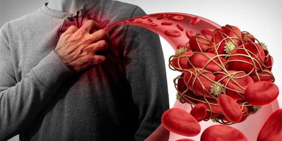 أعراض انسداد شرايين القلب وطرق التعامل معها